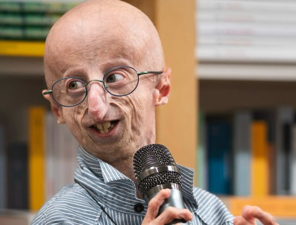 E’ morto Sammy Basso: malore al ristorante, era il più longevo malato di progeria al mondo