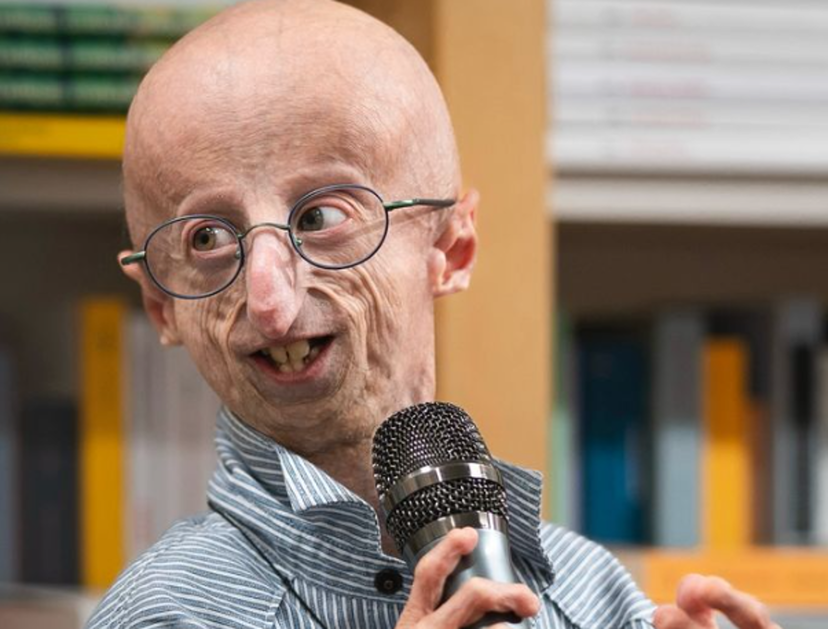 E’ morto Sammy Basso: malore al ristorante, era il più longevo malato di progeria al mondo preview