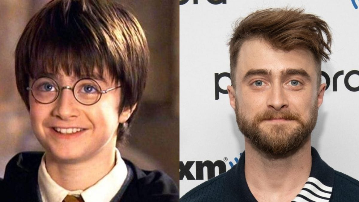 Daniel Radcliffe Ieri E Oggi Balbettante Bambocciona Banda Di Babbuini