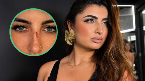 “Minacciata e aggredita”, Sabrina Soussi dopo Temptation Island mostra il volto segnato: il racconto shock preview