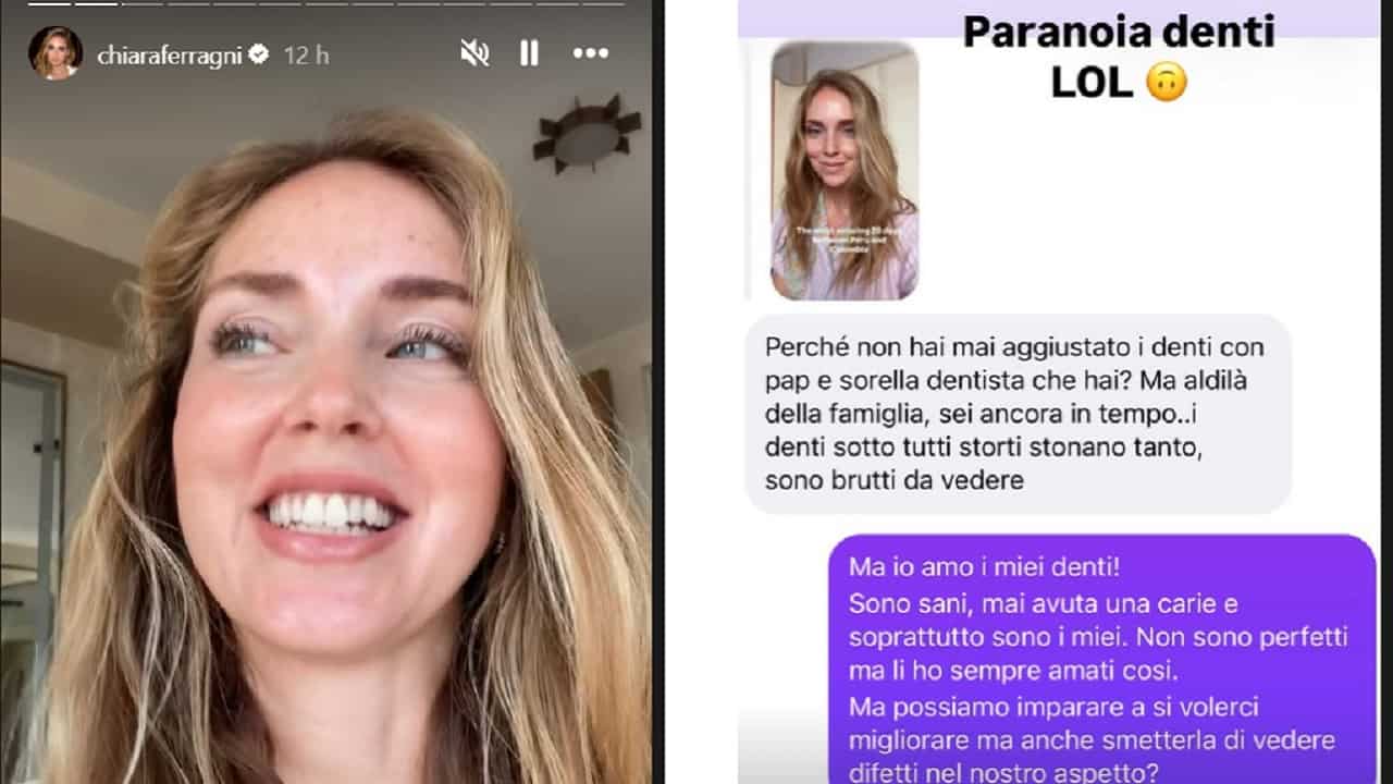 chiara ferragni risponde alle critiche sui denti