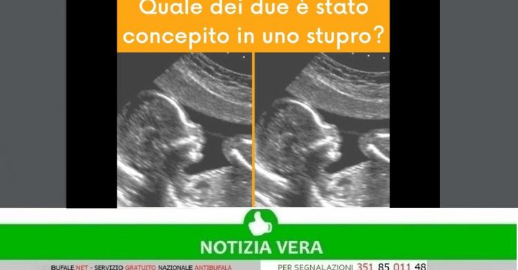 aborto da stupro