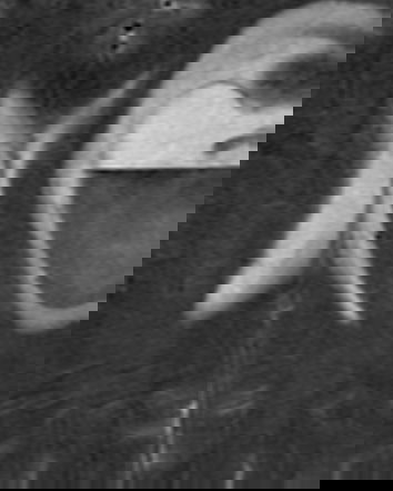 La dieta vegana che cura i tumori