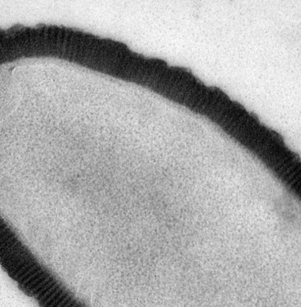 Il virus gigante siberiano article-post