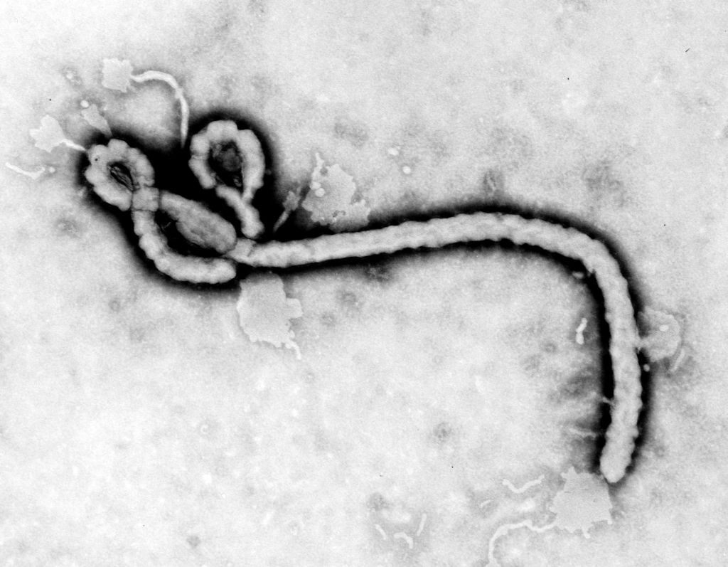 Ebola e xenofobia article-post