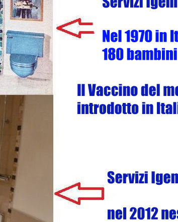 Morbillo e igiene personale