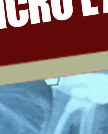 Il trattamento dentistico che (non) causa il cancro