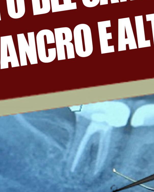 Il trattamento dentistico che (non) causa il cancro article-post
