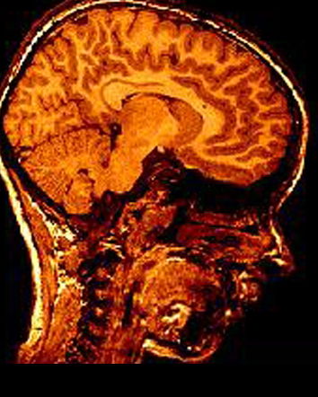 Cattivo giornalismo scientifico