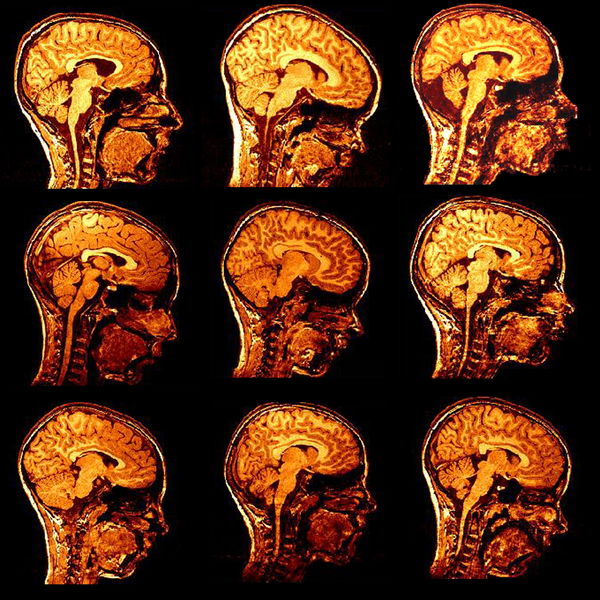 Cattivo giornalismo scientifico