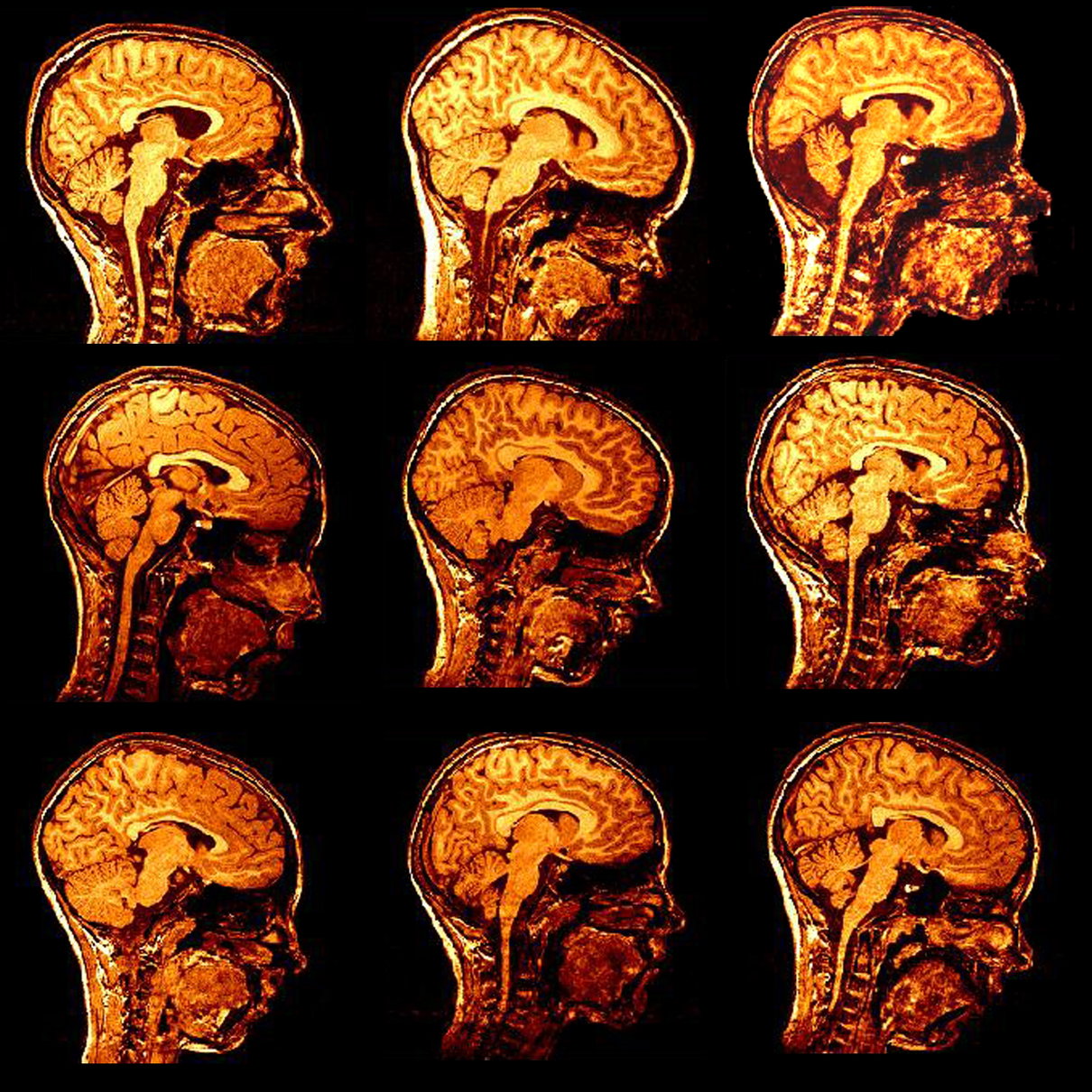 Cattivo giornalismo scientifico article-post