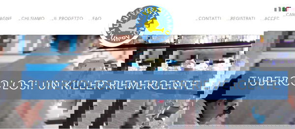 La ricerca sulla TBC