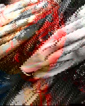 La ragazza ferita a Bologna