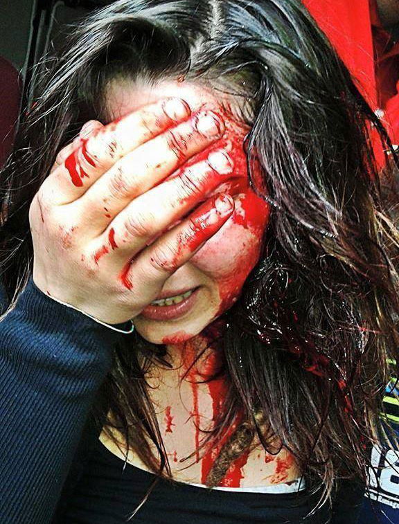 La ragazza ferita a Bologna article-post