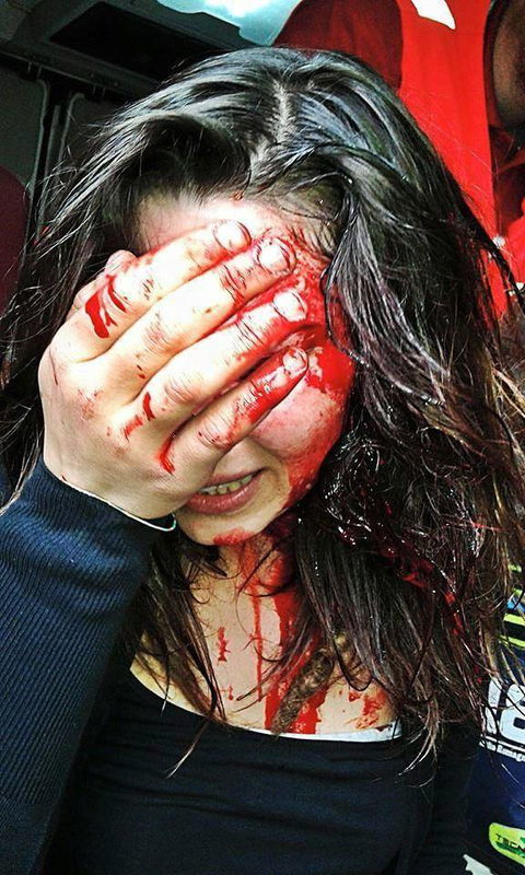 La ragazza ferita a Bologna