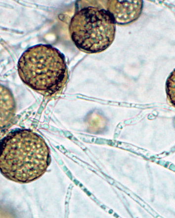 Naturale vs Artificiale – Riso Rosso Fermentato e Statine