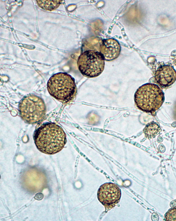 Naturale vs Artificiale – Riso Rosso Fermentato e Statine article-post