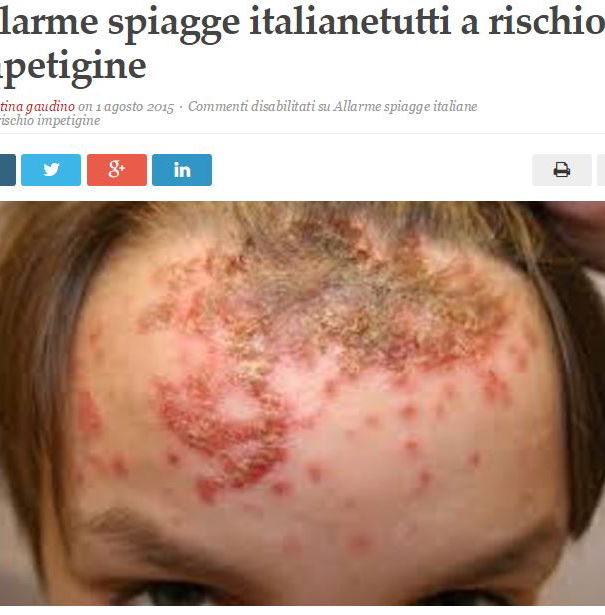 Allarme impetigine article-post
