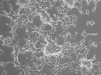 Informare X Resistere e la fuffa antiabortista article-post