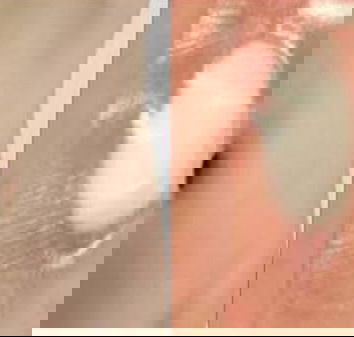 Il batuffolo di cotone nell’ombelico