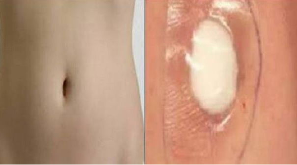 Il batuffolo di cotone nell’ombelico article-post