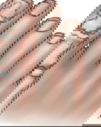 L’alluce valgo e la fuffa