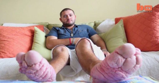 L’uomo con i piedi rovinati dalle scarpe cinesi article-post