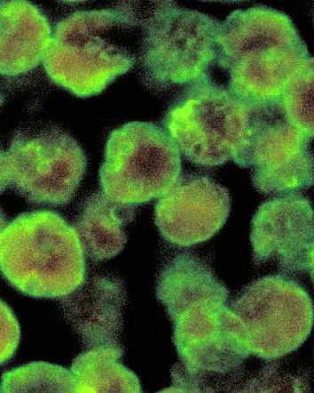 L’ameba mangia cervelli