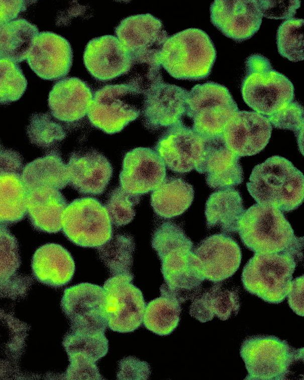 L’ameba mangia cervelli article-post