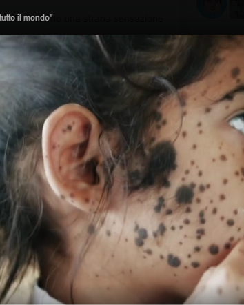 Prevenire è meglio che curare