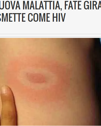 Malattia di Lyme, zonagrigia.com e allarmismo