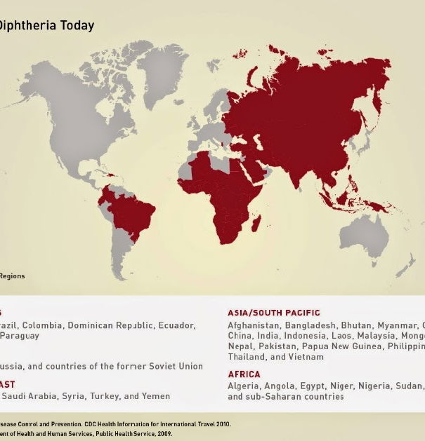 La difterite in Italia? article-post