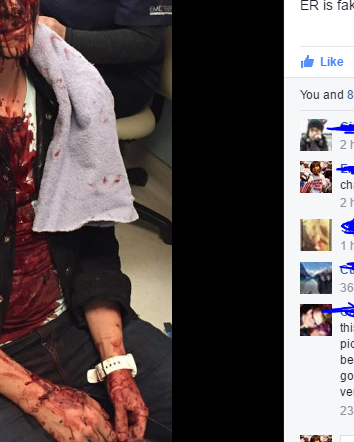 Il ragazzo gay picchiato dopo l’elezione di Trump