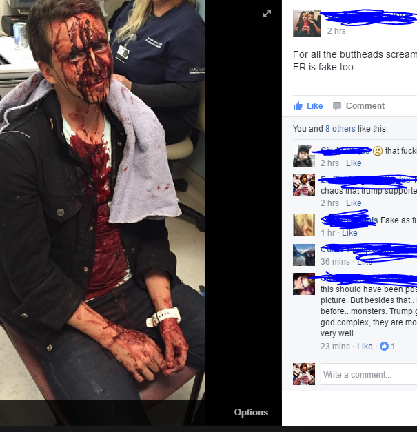 Il ragazzo gay picchiato dopo l’elezione di Trump article-post