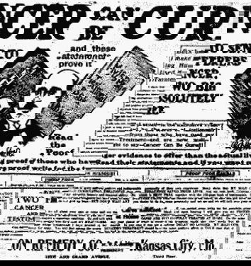 La termoablazione e il cancro (e due)