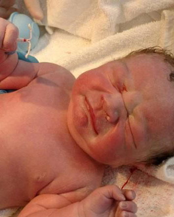 Il bimbo nato con la spirale in mano