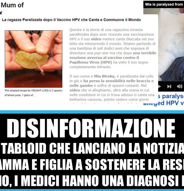 La ragazza (senza prove di essere) paralizzata dal vaccino per l’HPV article-post