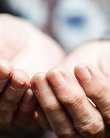 I fratelli italiani morti di fame