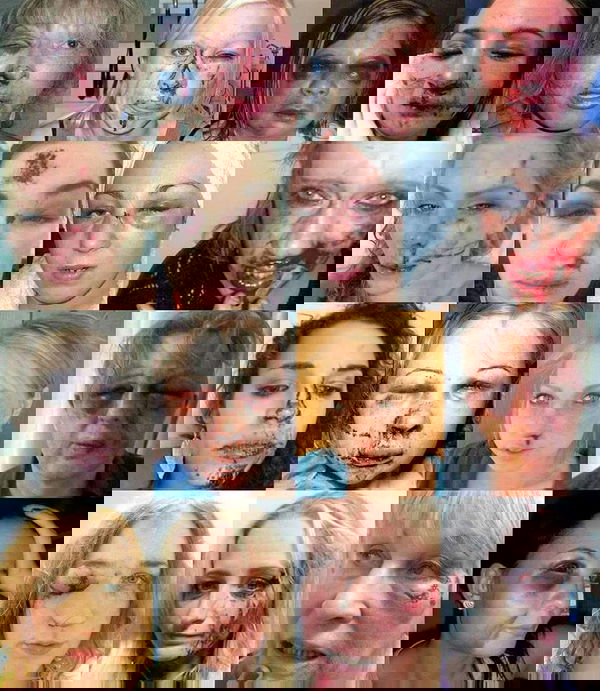 16 donne tedesche(?) picchiate da immigrati(?)