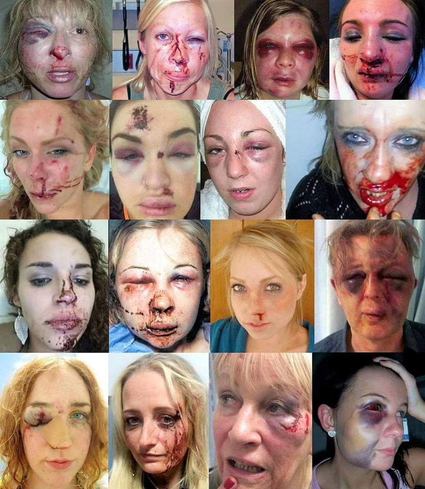 16 donne tedesche(?) picchiate da immigrati(?) article-post