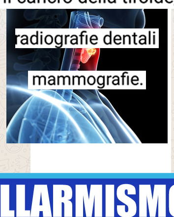 Ragazze leggete… tiroide e raggi X