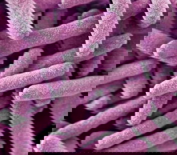 Tante Belle Cose – Tubercolosi e Migranti