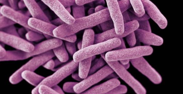 Tante Belle Cose – Tubercolosi e Migranti article-post