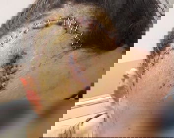 Maria, 19 anni, presa a calci dai gendarmi