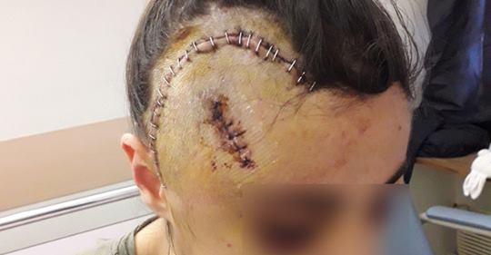 Maria, 19 anni, presa a calci dai gendarmi