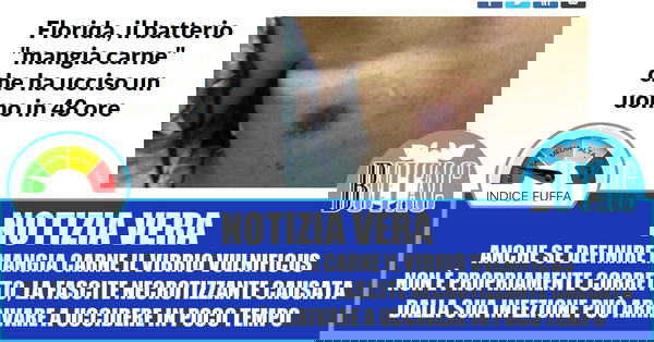 I batteri carnivori che uccidono in 48 ore