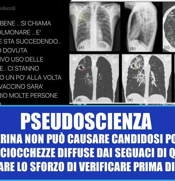 La candida polmonare e le mascherine article-post