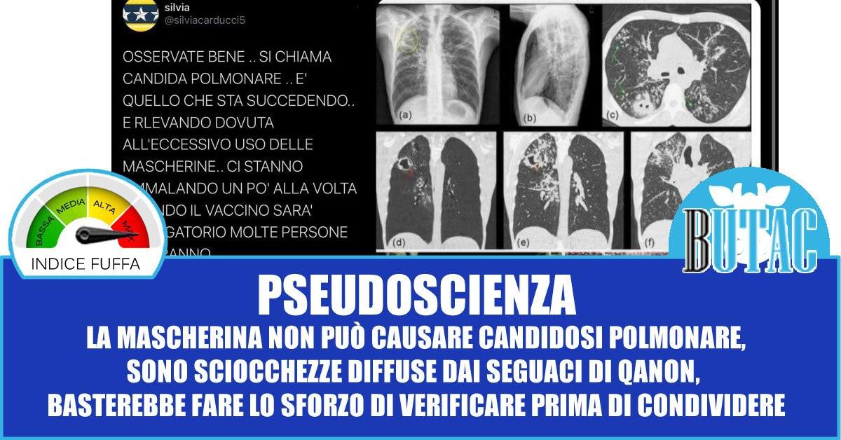 La candida polmonare e le mascherine article-post