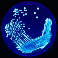 piastra Petri con colonie di Legionella