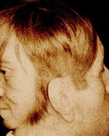 Le due facce di Edward Mordake